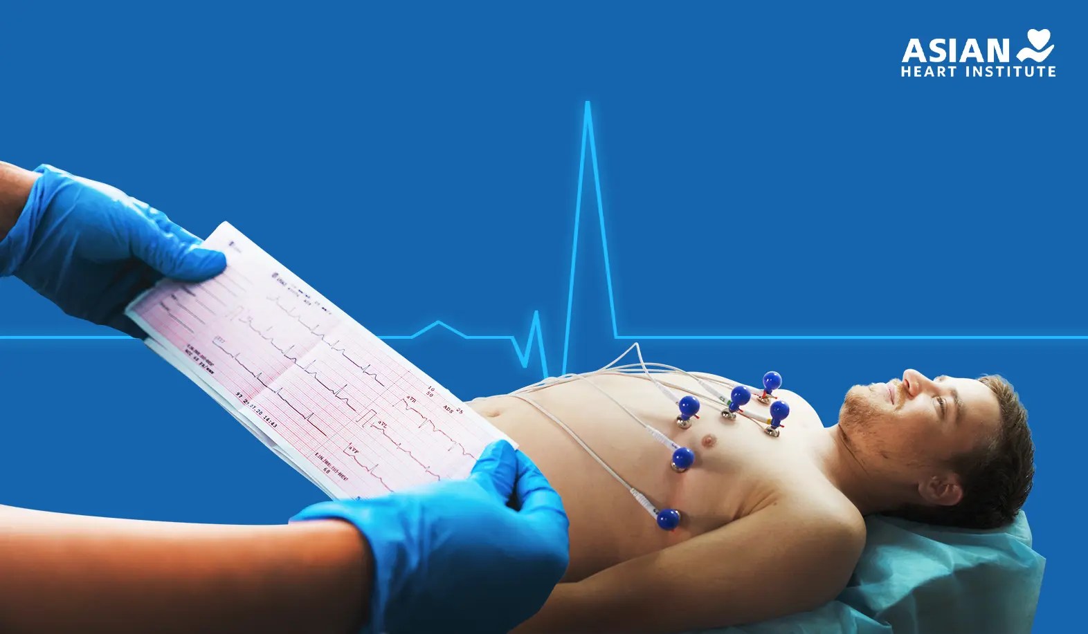 نوار قلب (ECG)