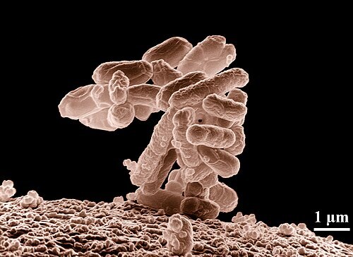 آیا نانوپلاستیک‌ها می‌توانند باکتری E. coli را خطرناک‌تر کنند؟