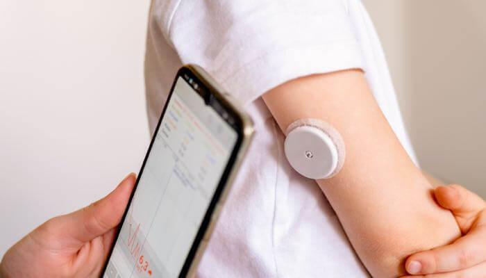 کاهش چشمگیر قند خون در سالمندان دیابتی با استفاده از CGM با اسکن متناوب