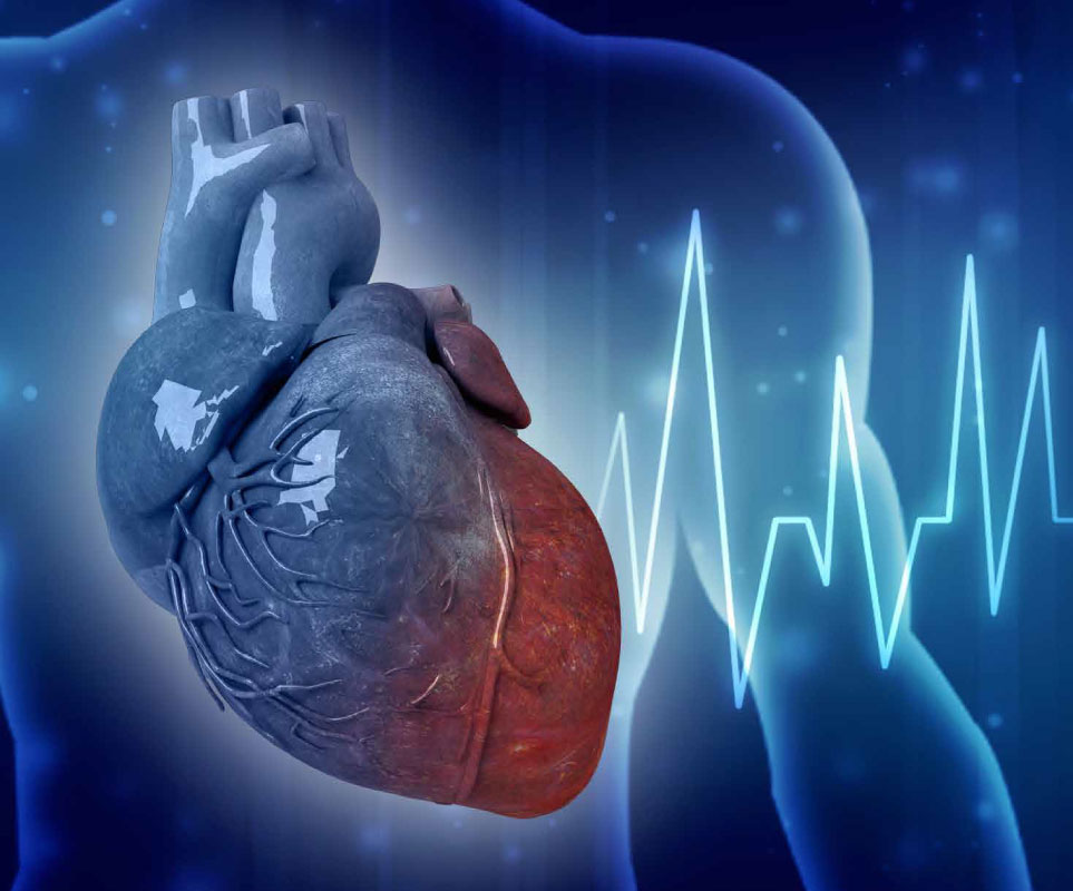 آریتمی قلبی چیست؟ علل، علائم و روش‌های درمان بی‌نظمی ضربان قلب